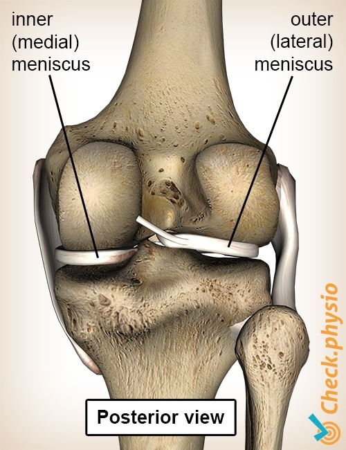 Knie Meniskus Rückseite