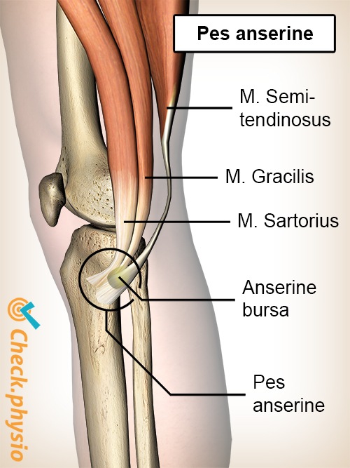 Knie Pes anserinus Schleimbeutel Bursa Sartorius Gracilis Semitendinosus Sehnen Gänsefuß-Syndrom