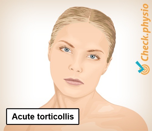 Hals Torticollis Abweichung Haltung