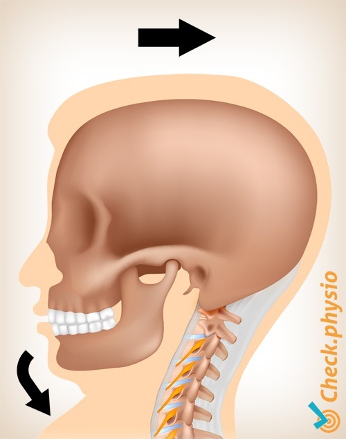 Nacken Whiplash Schmerz Bewegung 1