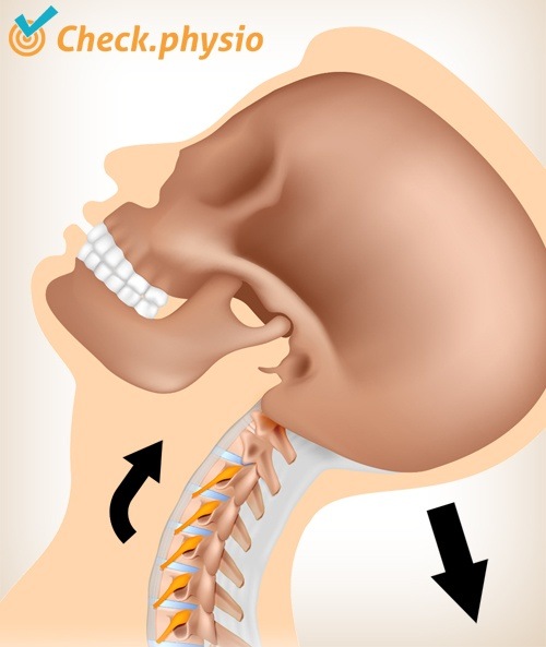 Nacken Whiplash Schmerz Bewegung 3