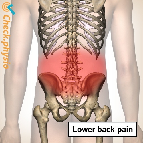 Rücken niedrige Rückenschmerzen Wirbelsäule Skelett