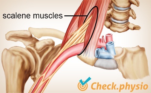 Schulter Arm Hand TOS Thoracic-outlet-Syndrom Skalenuslücke