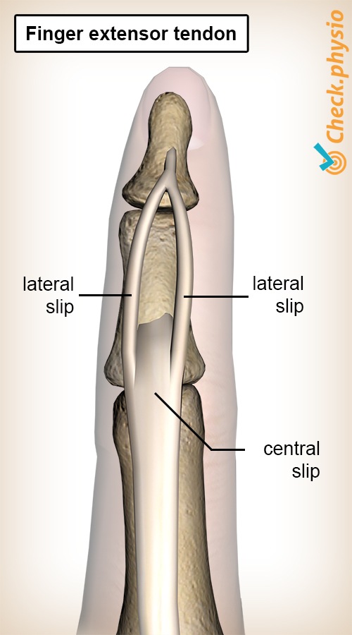 Finger Strecksehne Schlupf