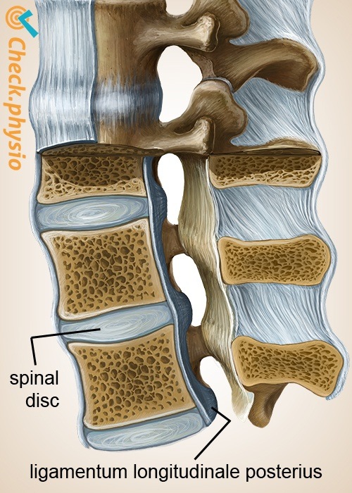 Wirbelsäule Ligamentum longitudinale posterius Bandscheibe Diskus