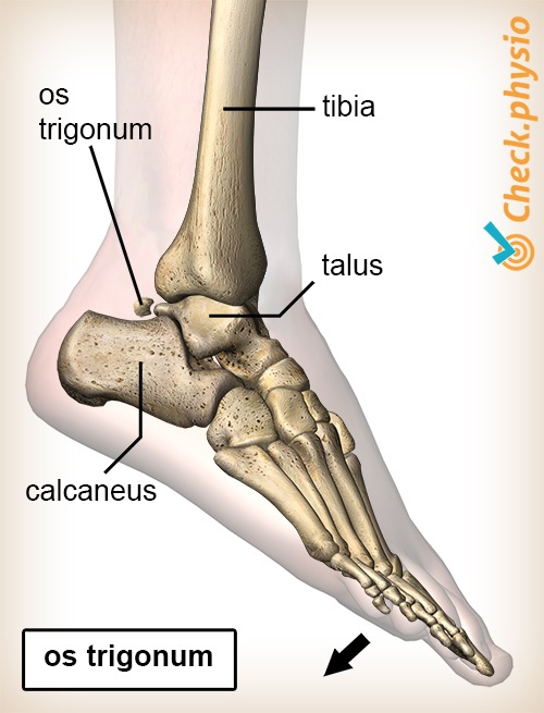 Knöchel hinteres Impingement Os Trigonum