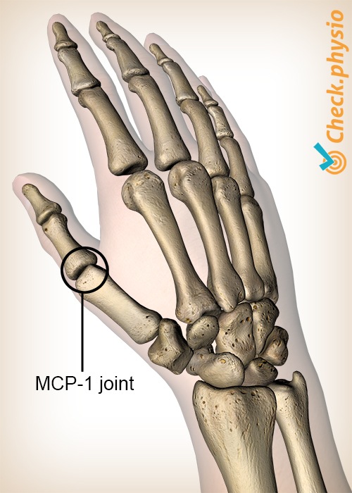 Hand-MCP-1-Daumen