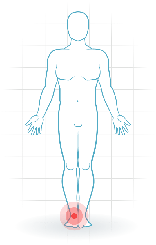 pijnlocatie Anteriore Knöchel-Impingement